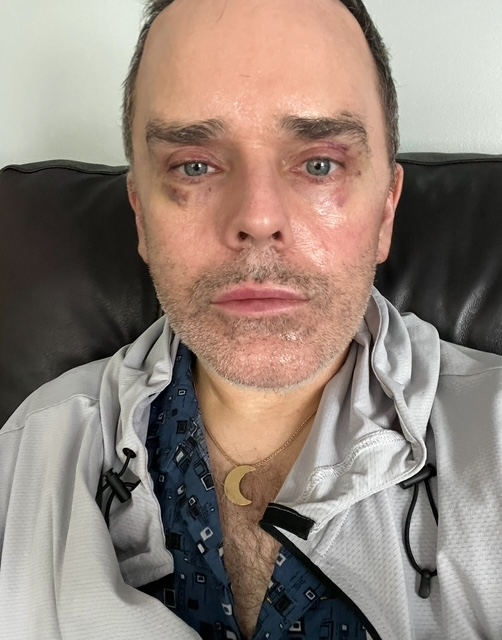 En person sitter på en sofa med en jakke over en mønstret skjorte, med et halvmånehalskjede synlig