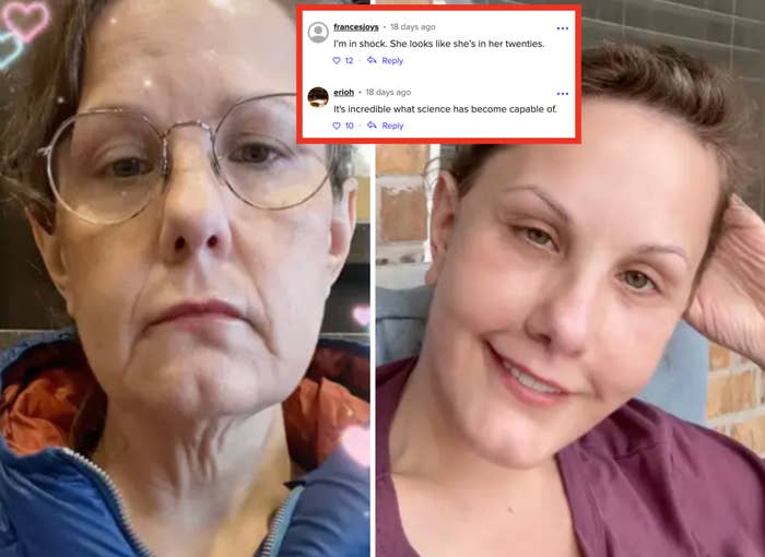 Side om side bilder av en person før og etter en transformasjon, som viser en endring i uttrykk og antrekk, fra en jakke til en uformell topp