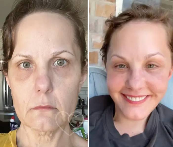 Delt bilde av en kvinne før og etter hudpleierutine, og viser en klar transformasjon fra alvorlig til å smile med glatt, strålende hud