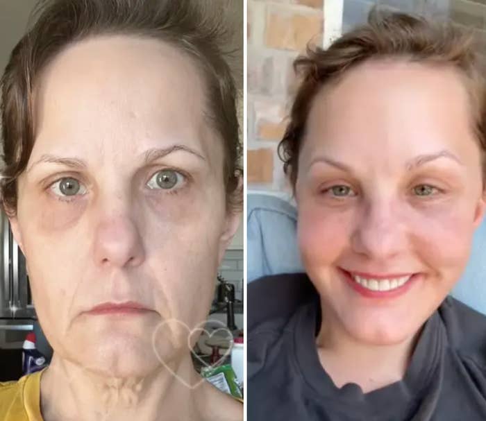 To bilder side om side av en kvinne. Venstre viser et nøytralt uttrykk, og høyre viser henne smilende