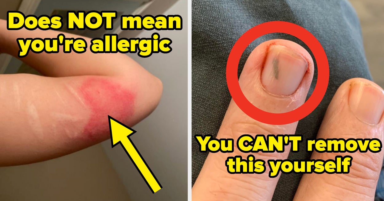 Medisinske fagpersoner roper ut de største "helsefeilene" tror folk fortsatt (men burde egentlig ikke)