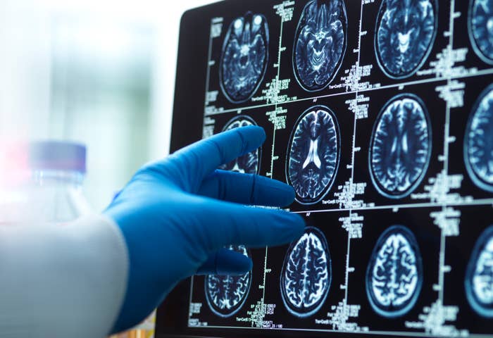 Hanskte hånd som peker på hjerneskanninger på en skjerm, og fremhever områder for analyse eller medisinsk gjennomgang