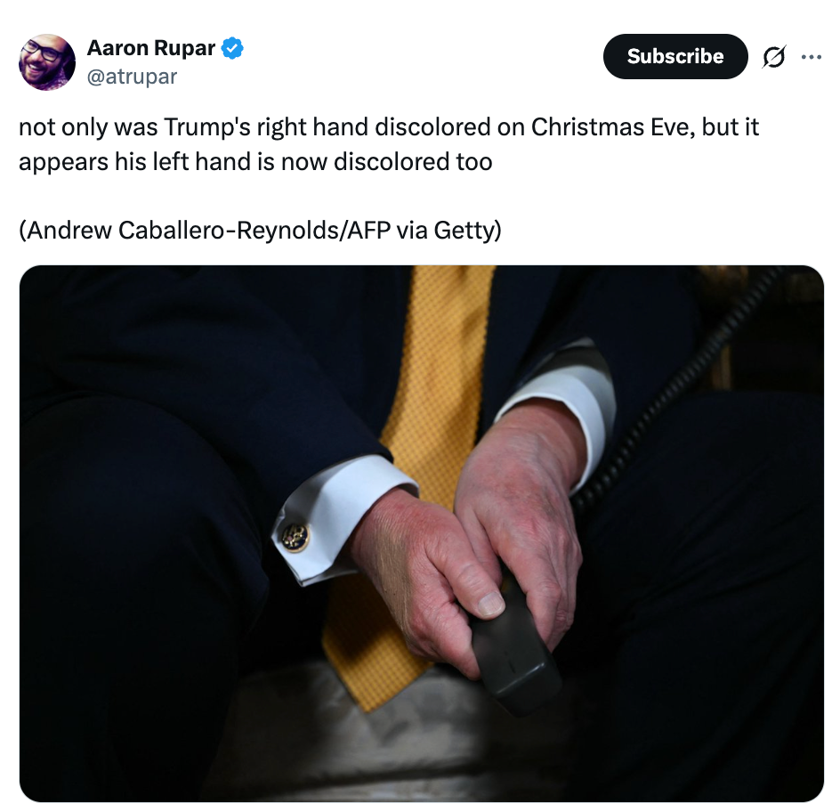 En person i dress holder en telefon. Tweeten noterer misfarging på hendene deres, nevnt som forekommende ved tidligere anledninger