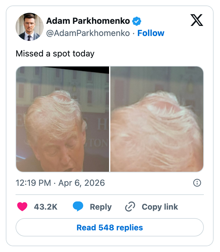 En tweet inneholder to side-ved-side-bilder som viser en person med en synlig skallet flekk, med teksten 