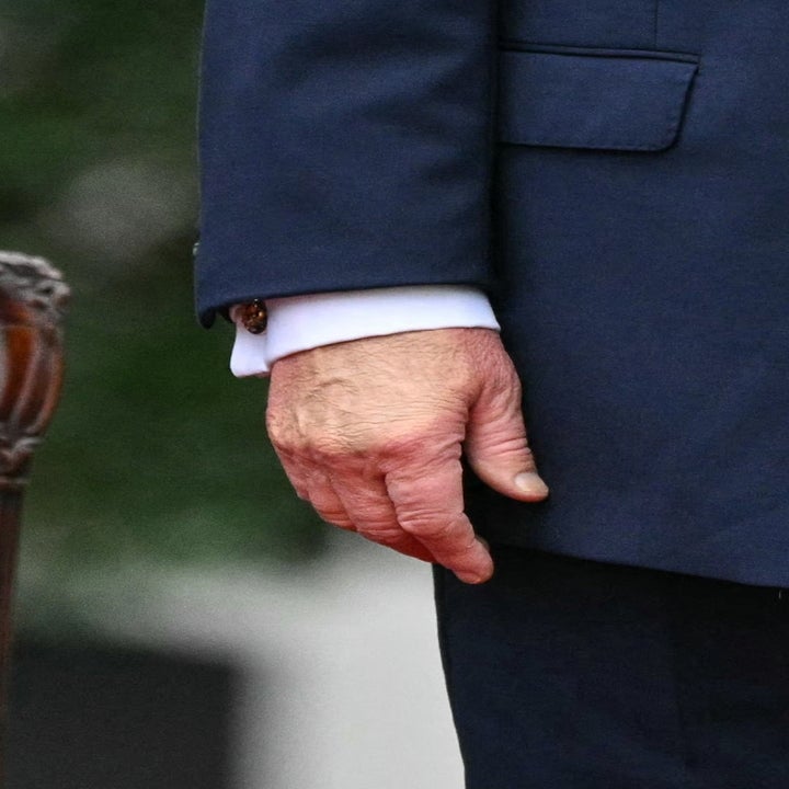 Donald Trumps hender og midjeområde, begge hender har sminke på seg