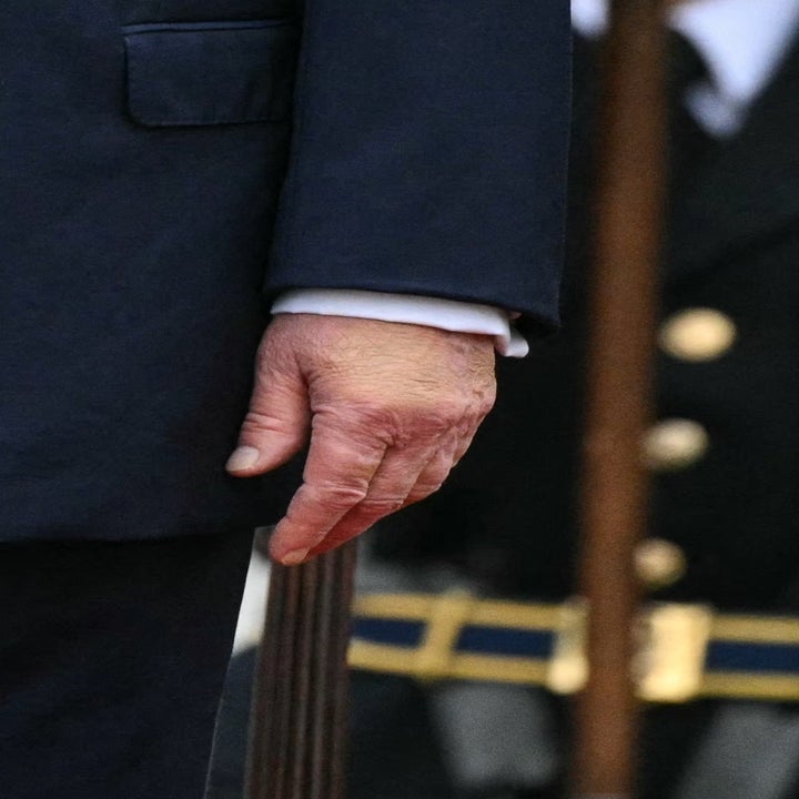 Donald Trumps hender og midjeområde, begge hender har sminke på seg