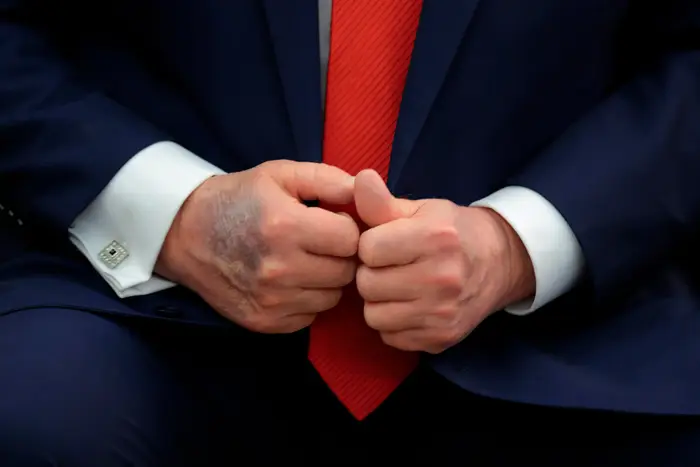 Donald Trump satt med hendene knyttet sammen foran, iført dress og slips. Høyre hånd er synlig forslått