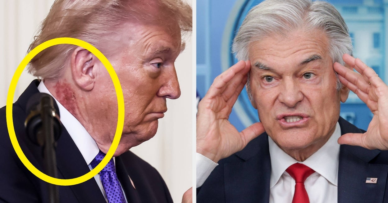 Internett er i grus etter at Dr. Oz ga denne forklaringen på hvorfor Trump fortsetter å gå til legen