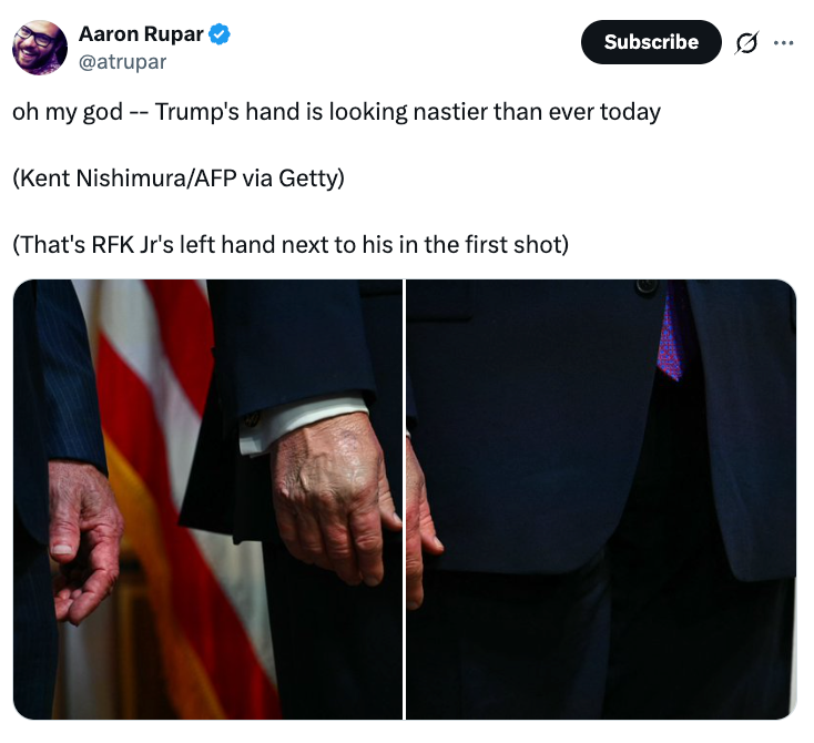 Delt bilde av to hender; man ser gammel og rynket ut. Sosiale medier-innlegg som diskuterer hendene med referanse til RFK Jr