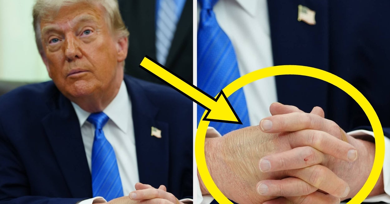 En medisinsk ekspert har nettopp droppet 7 presserende helsespørsmål til Trump, og wow, jeg vedder på at Det hvite hus ikke kommer til å være lykkelig