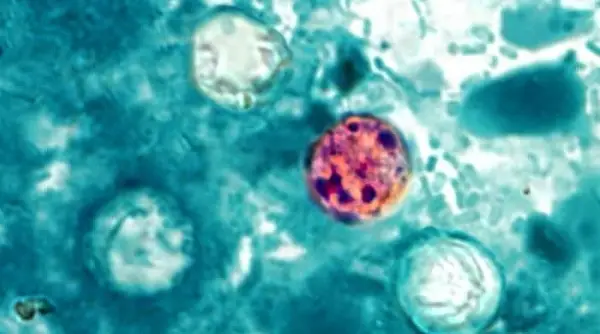 Mikroskopisk visning av Cyclospora cayetanensis parasitt med distinkte indre strukturer